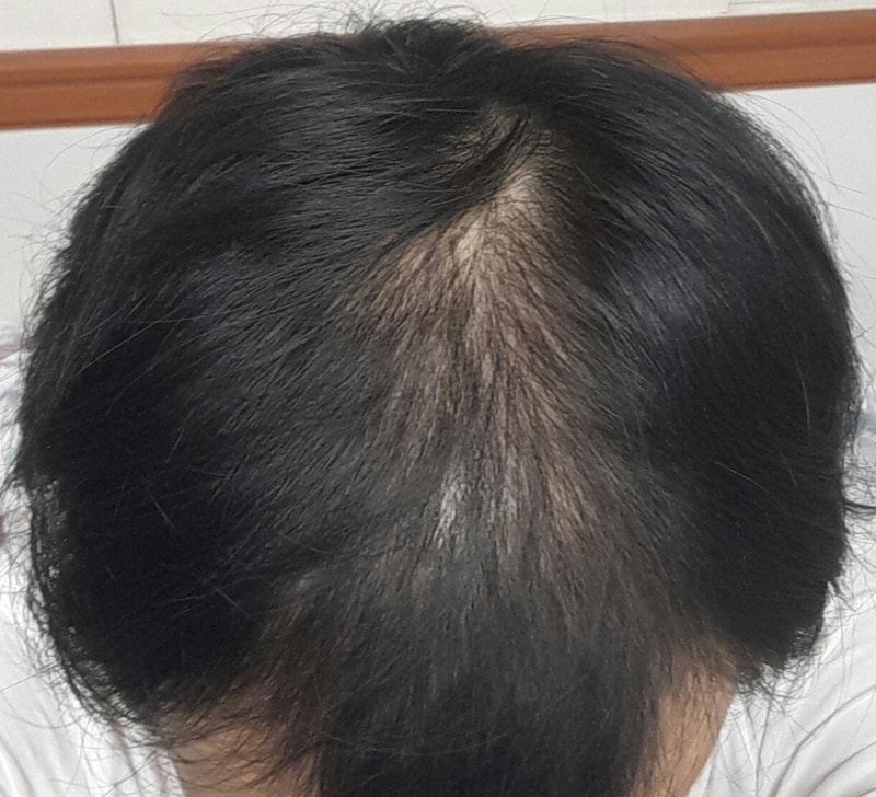 1) 20170407 상.jpg