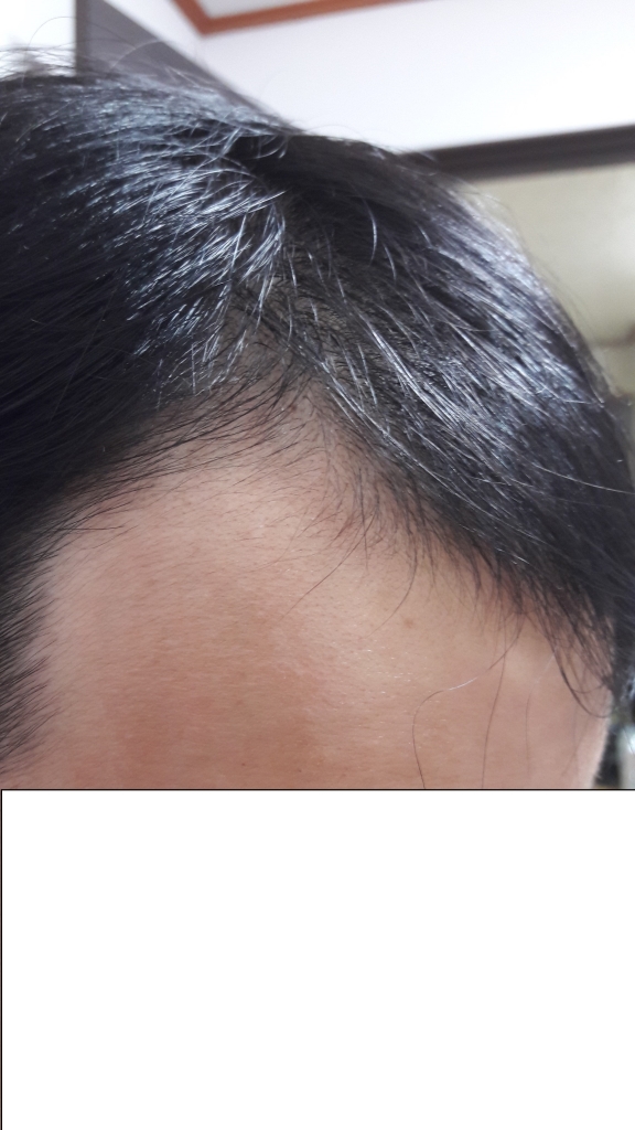 2-2) 20170703 우.jpg
