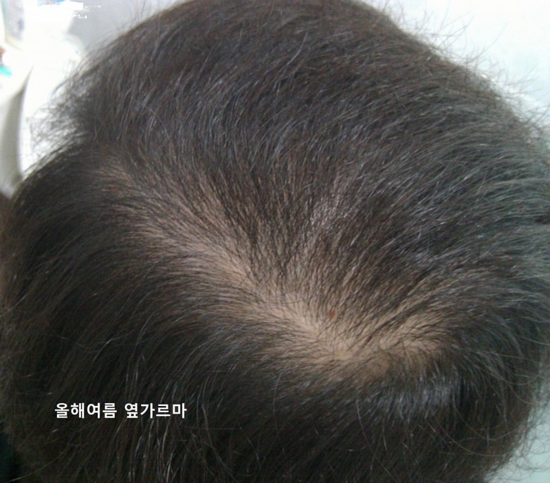올릴파일 옆가르마.jpg