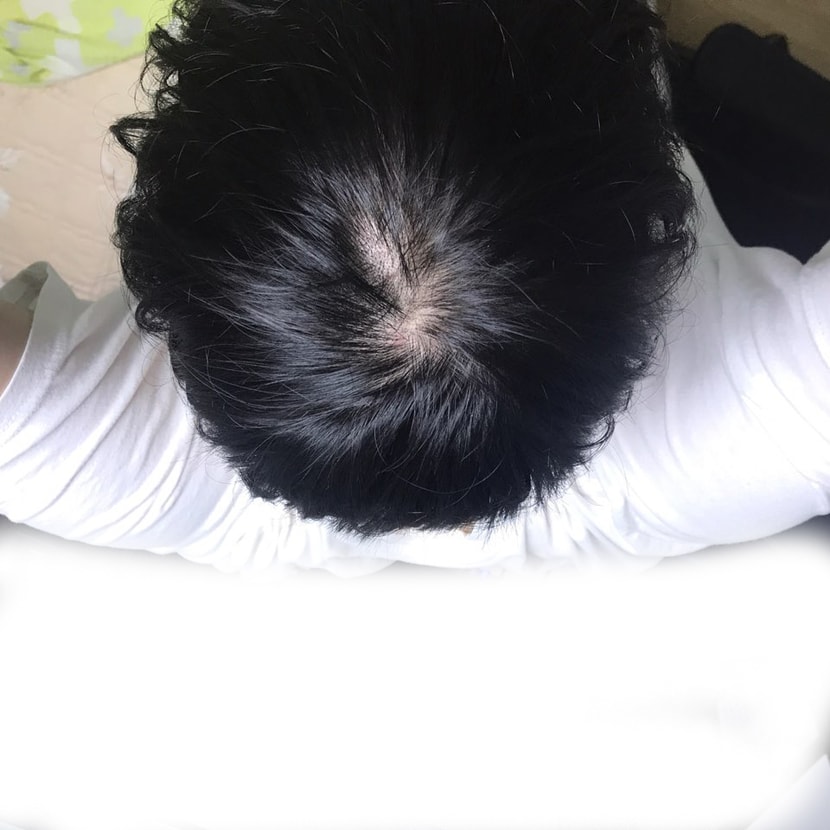 쉐딩