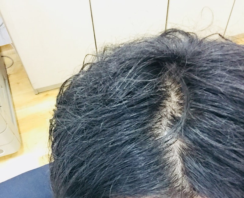 KakaoTalk_20180809_191349140.jpg