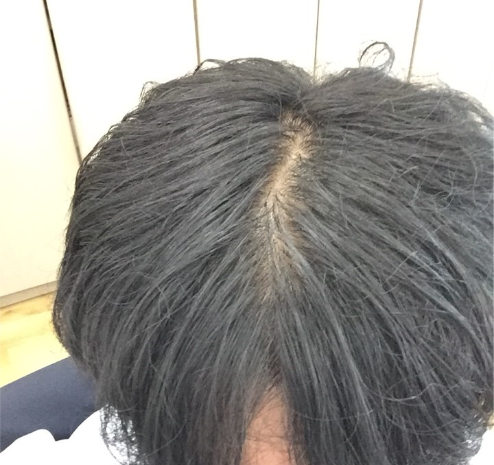 KakaoTalk_20180726_112302502.png