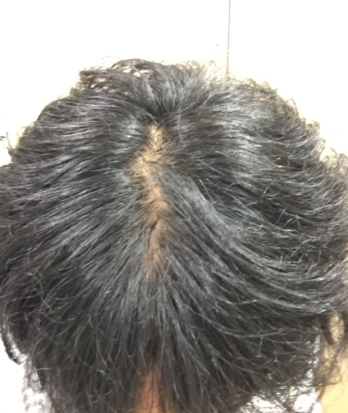 KakaoTalk_20180726_112240659.png