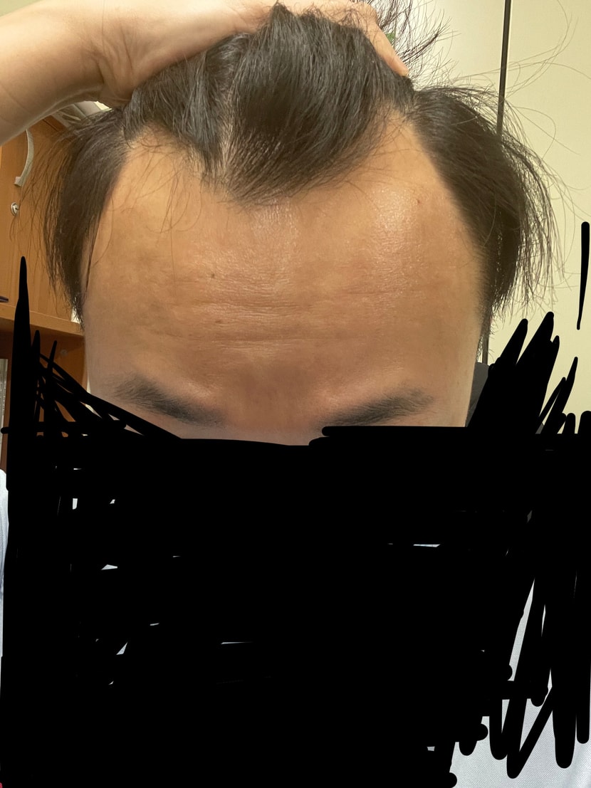 이마