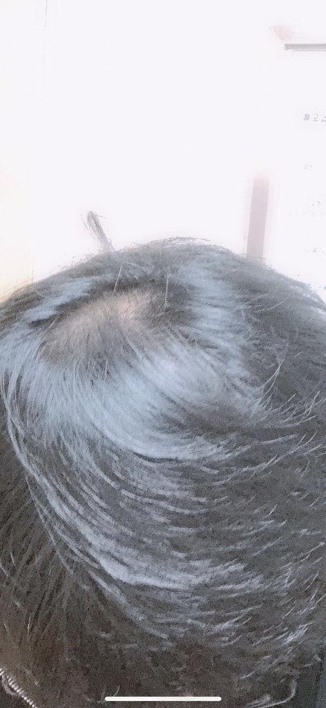 B01E1512-2D8D-40DE-9AE3-987B71999251.png