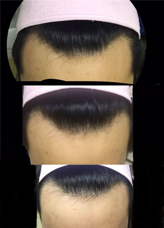 최종 2.png