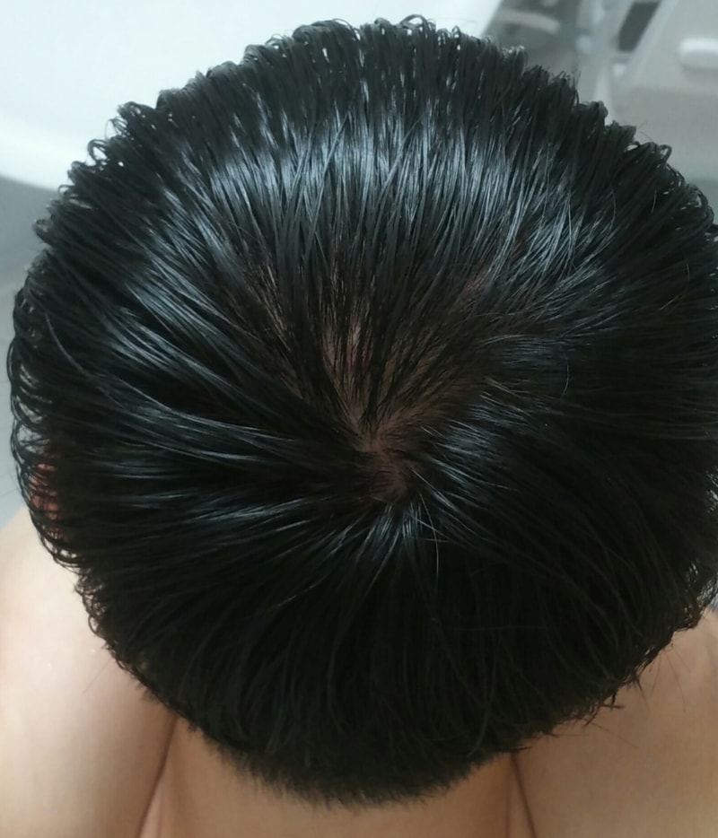 CROP_20170305_004002.JPG