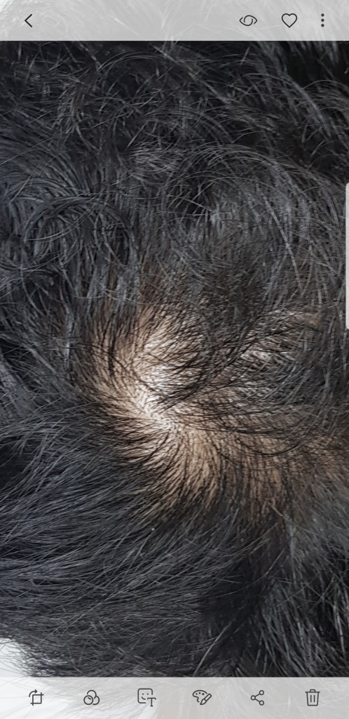 Screenshot_20190220-005450_Gallery.jpg