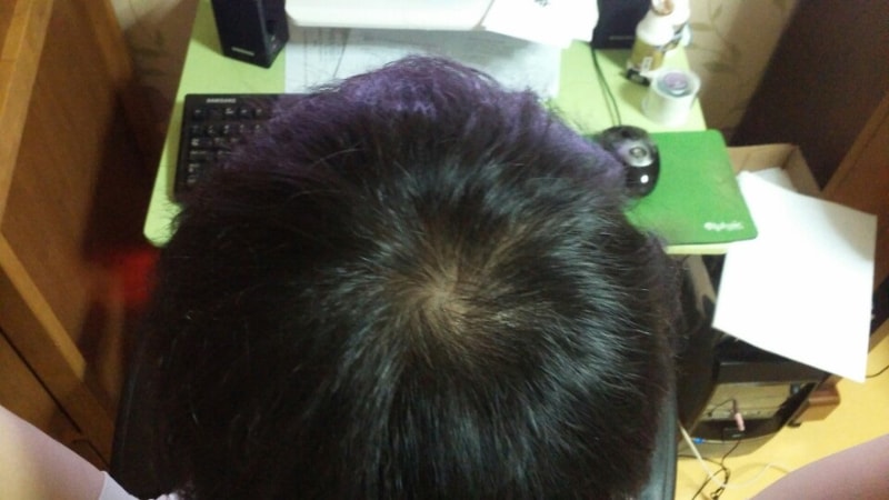 정수리.jpg