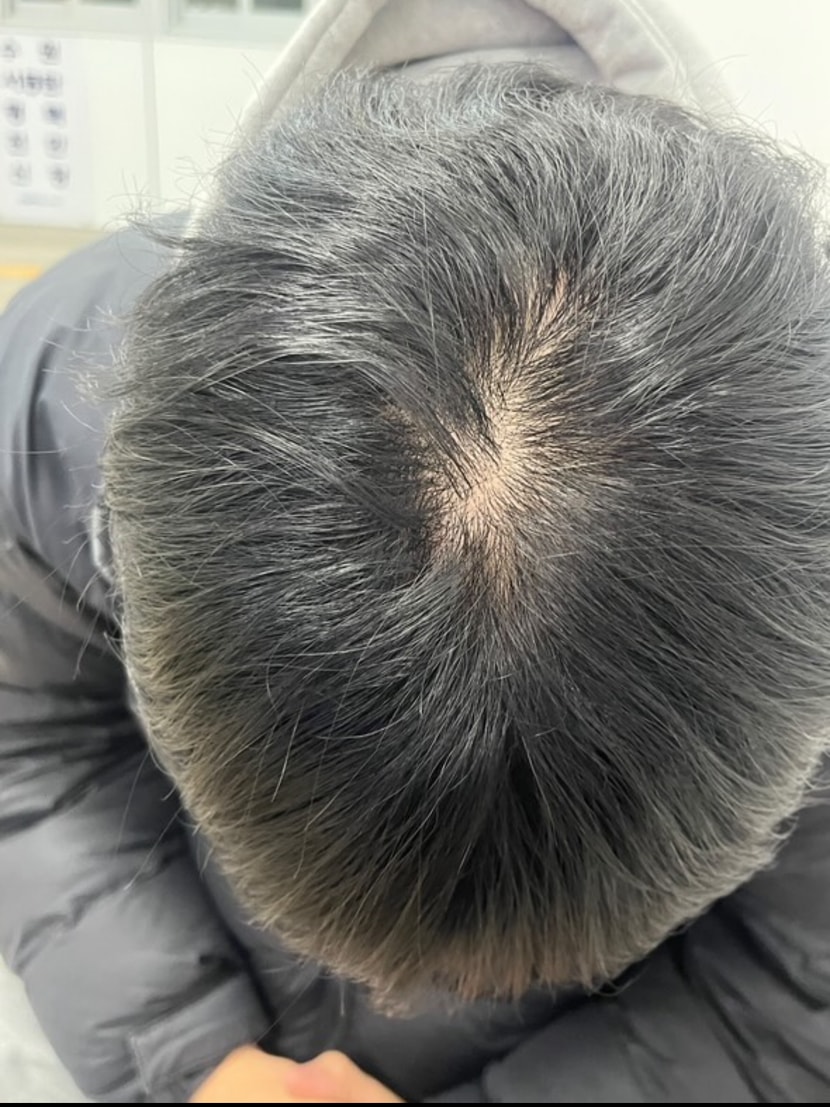 복용 전