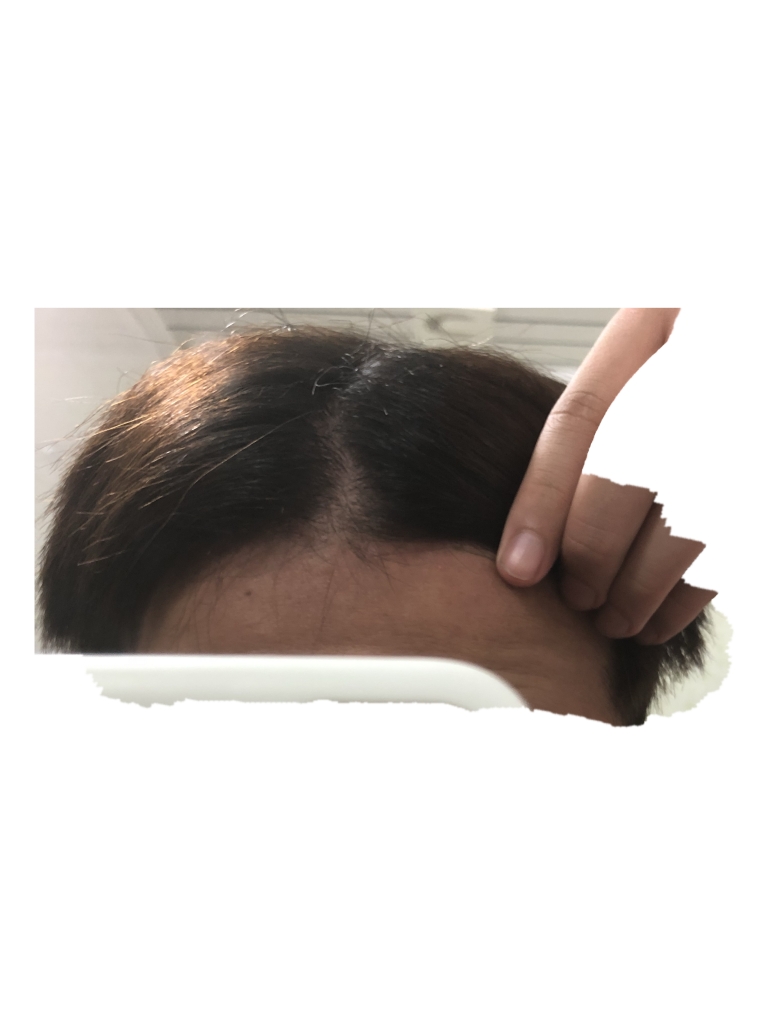 BE1FFD50-3D9E-4A5D-BF10-EC7088D73EB5.png