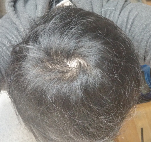 사본 -20161115_094110_HDR.jpg