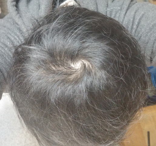 2-20161115_094110_HDR.jpg