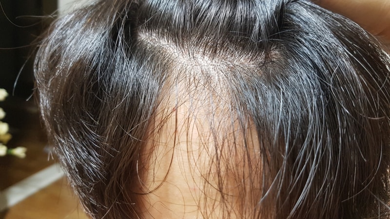 수정됨_6월 말 오른쪽.jpg