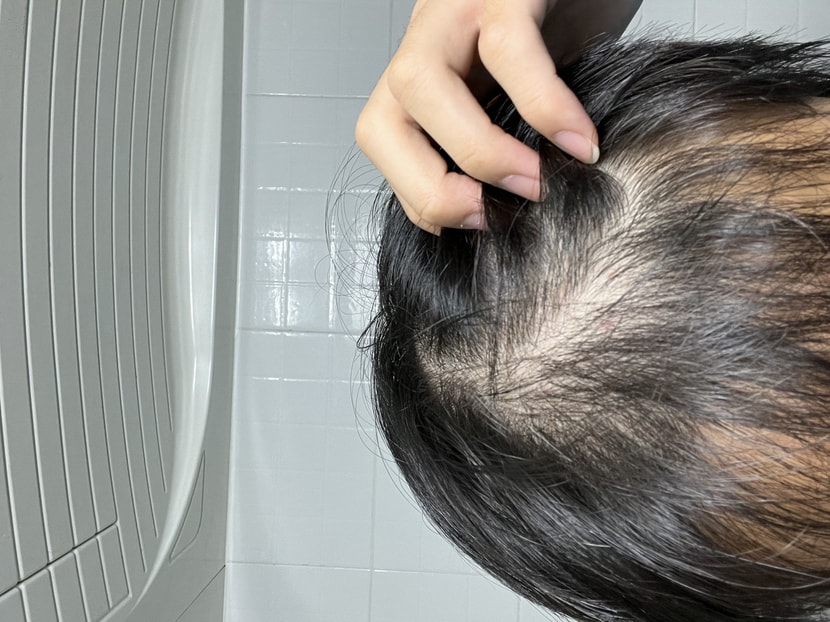 앞머리 부분