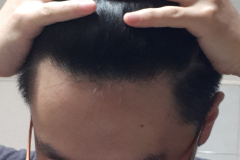 20180304_234113.jpg