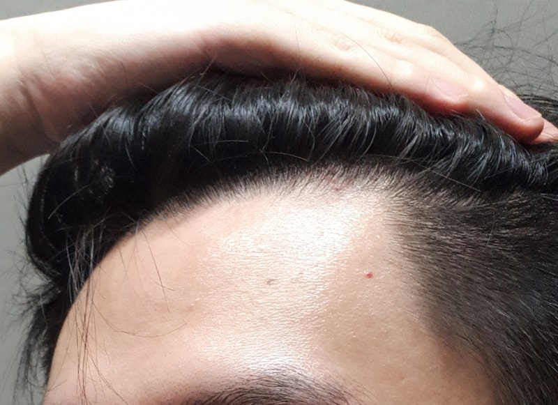 20180304_234013.jpg