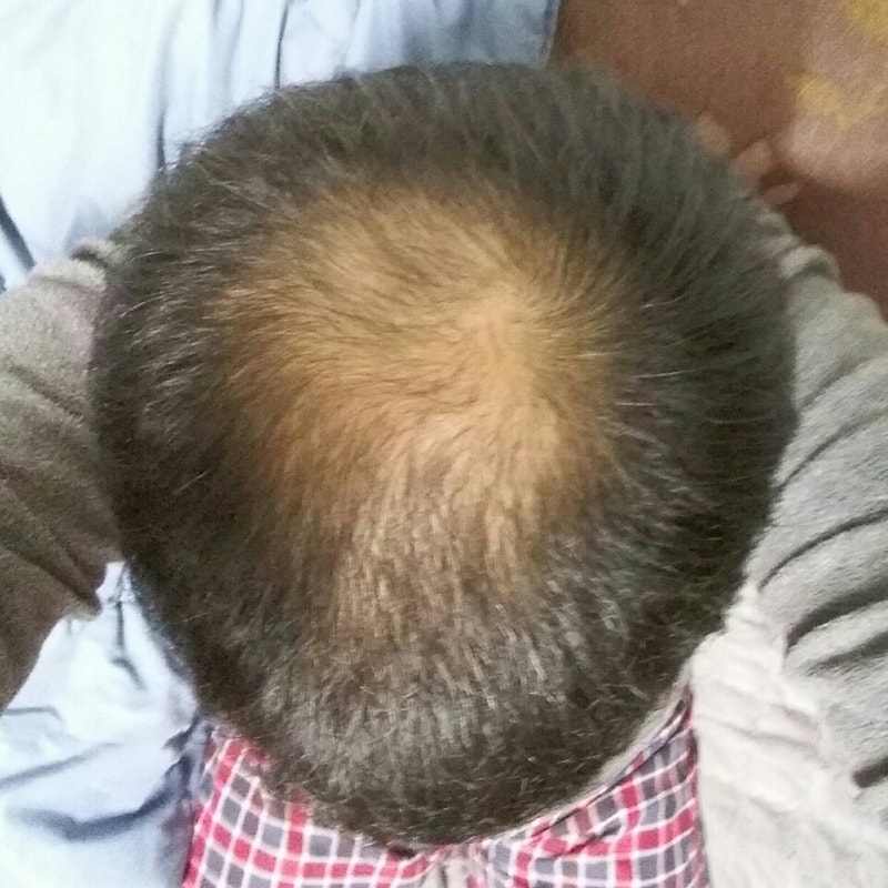 현재상황.jpg