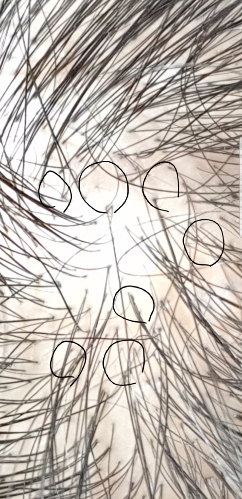 20171120_204332.png