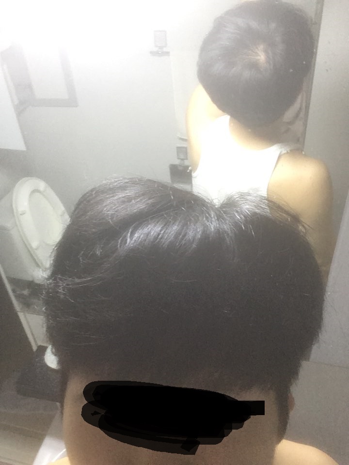 3. 정수리.jpg