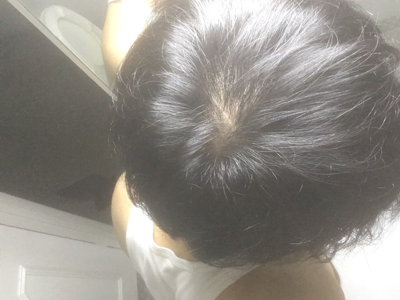 4정수리.jpg