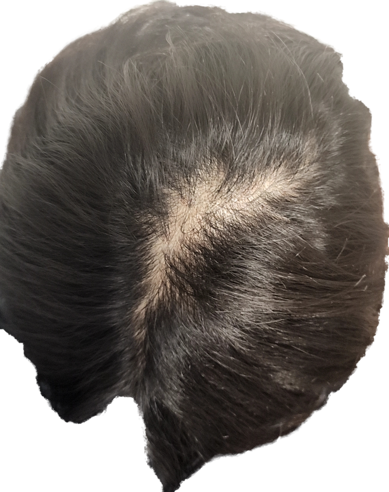 20221105_183141597.png