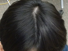 정수리220610_4.PNG