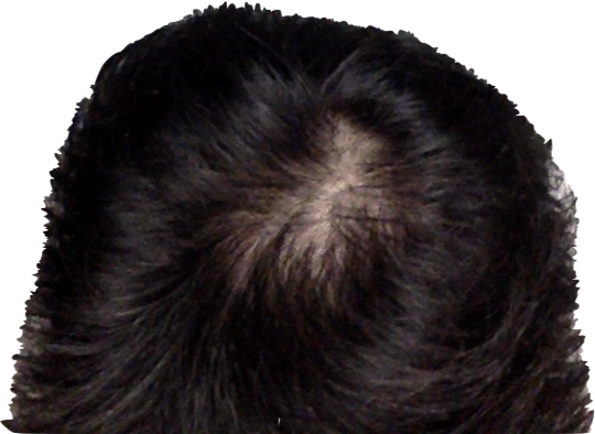 Picture1.png