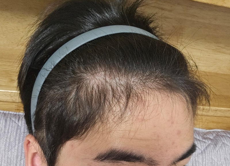 1000041910.jpg