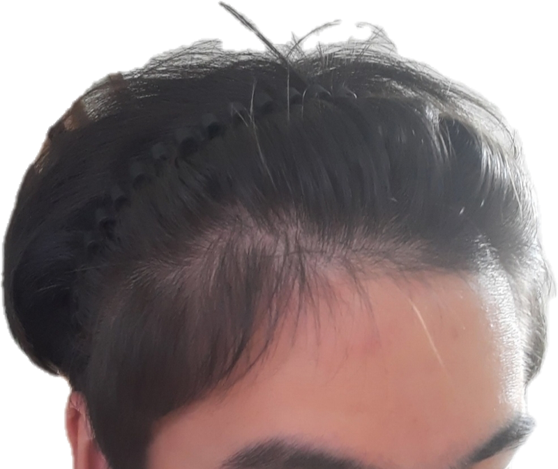 1000065823.png