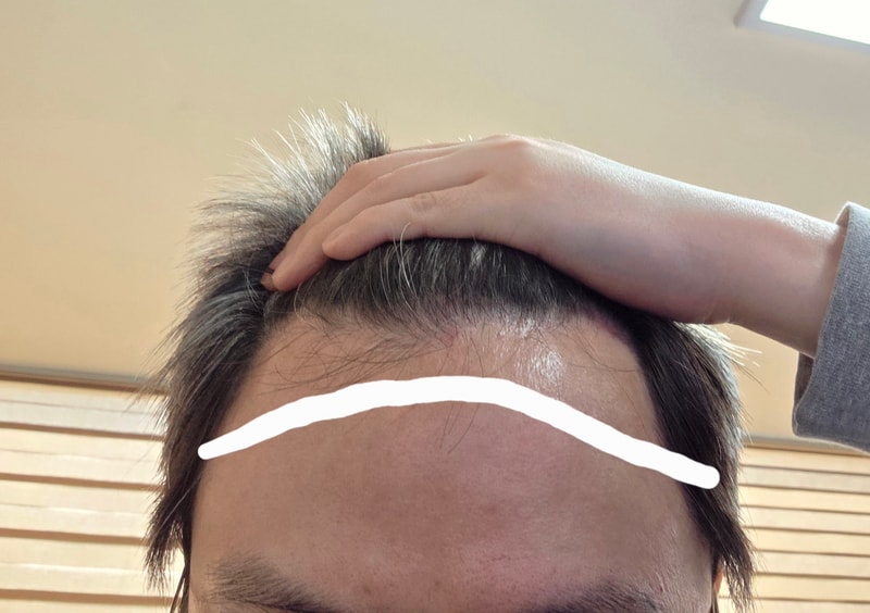 이마.jpg