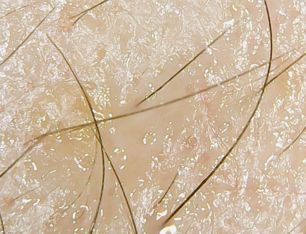555_00000.jpg