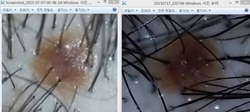 폴텐 7일차vs 17일차.jpg