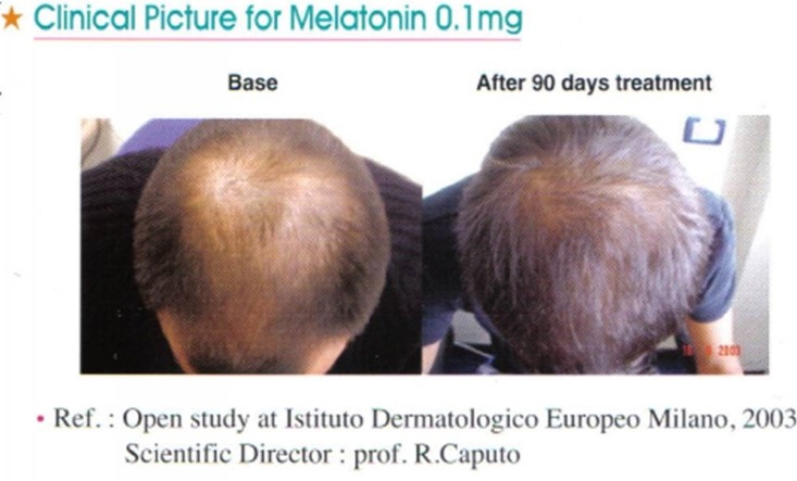 mellatonin.jpg