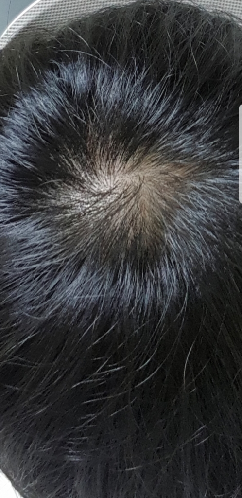 Screenshot_20180617-233542_Gallery.jpg