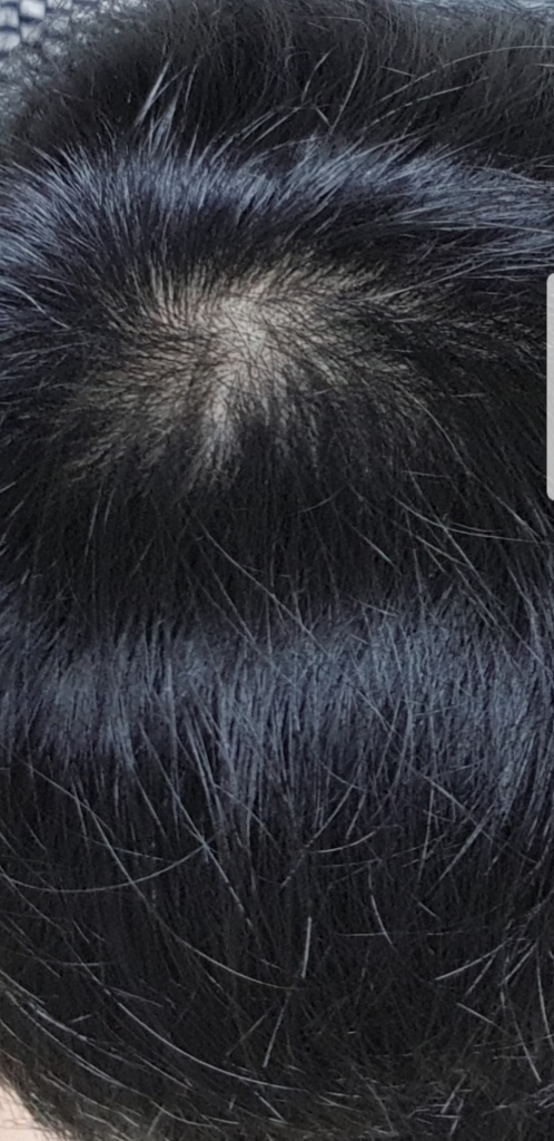 Screenshot_20181102-045403_Gallery.jpg