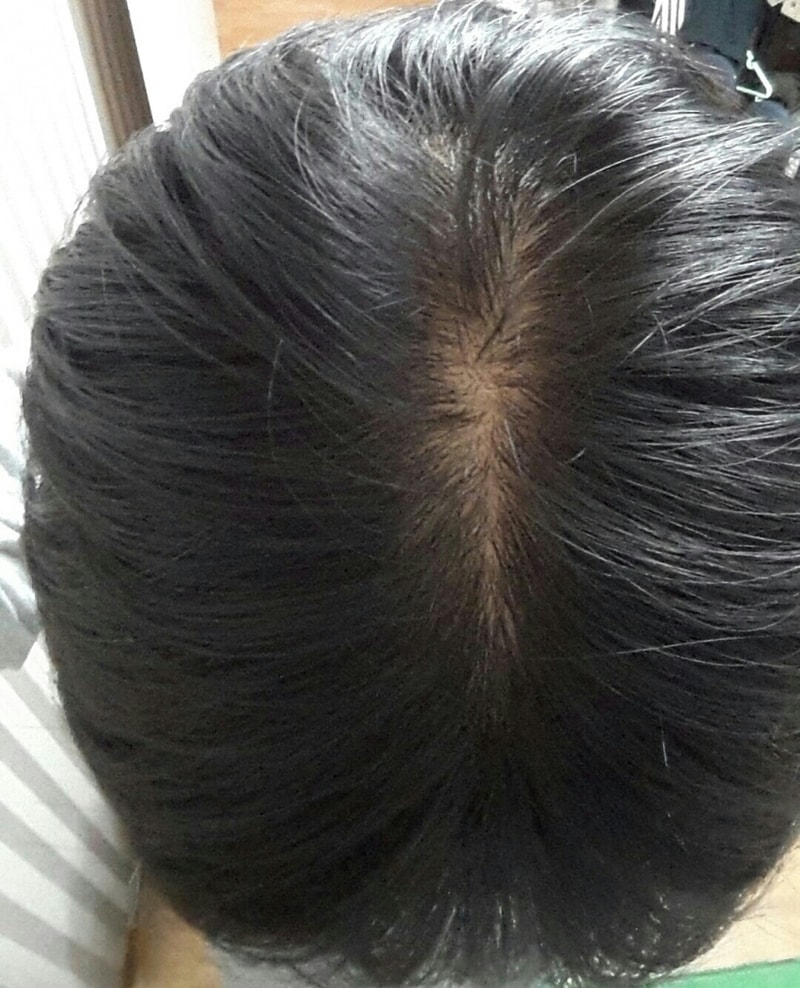 20190104_213103-1-1.jpg