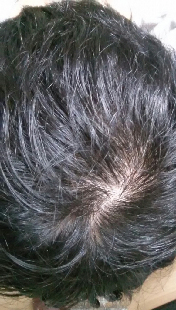 20150126_192433.jpg