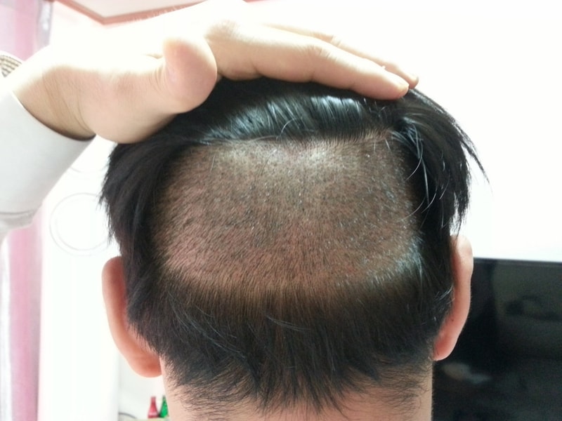 뒷모습1.jpg