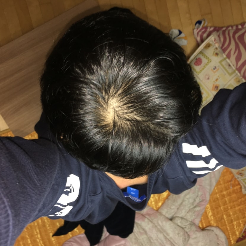 머리 깎고 난 후