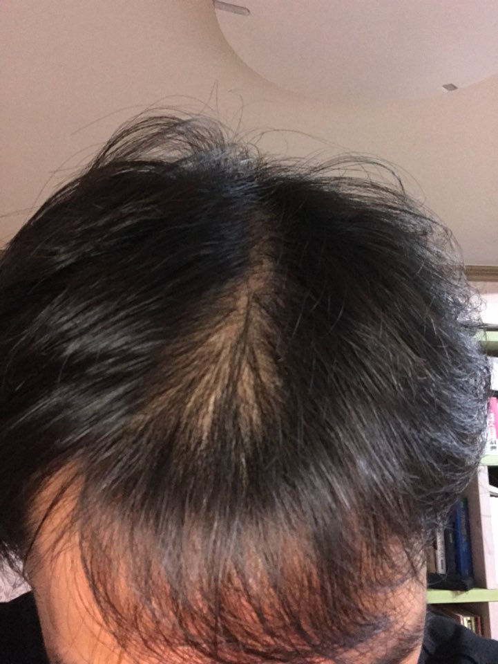 KakaoTalk_20180701_230352113.jpg