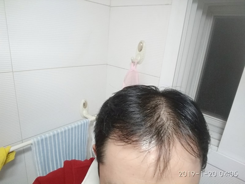 IMG_20190120_040517.jpg