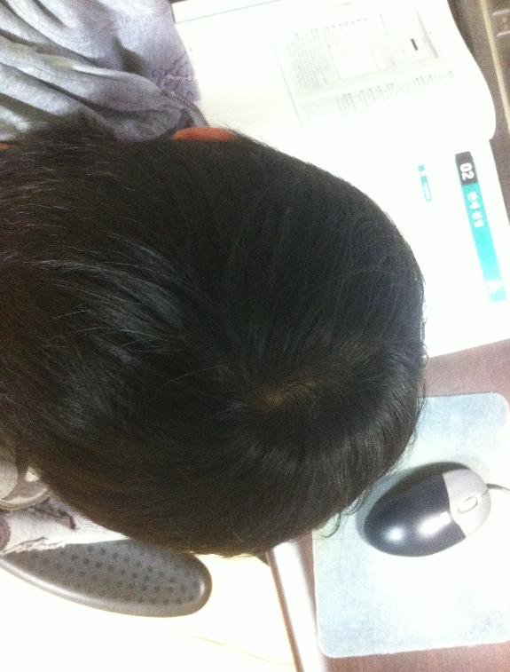 정수리1.JPG