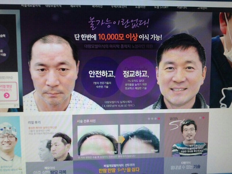 모발사진1.jpg