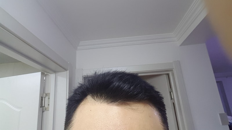 20180323_193110.jpg