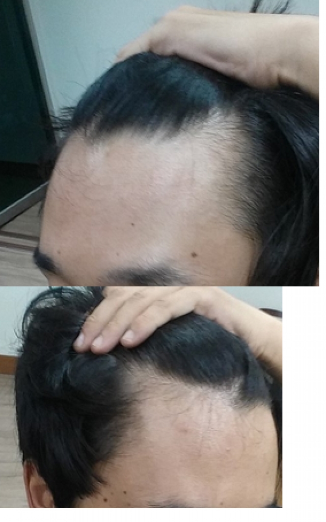 오른쪽 왼쪽.png