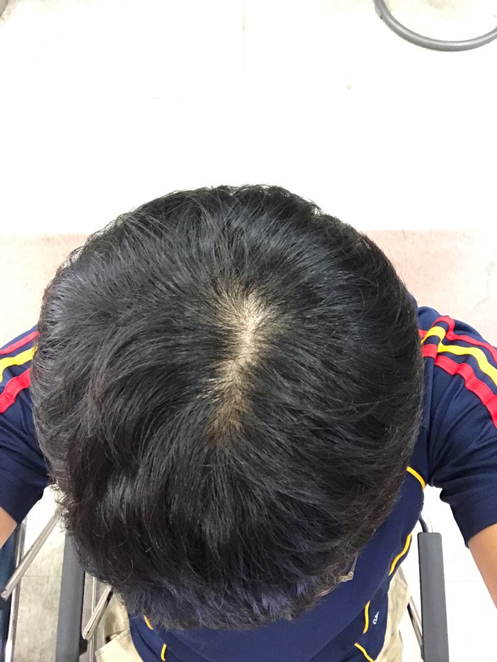 KakaoTalk_20170825_154858515.jpg