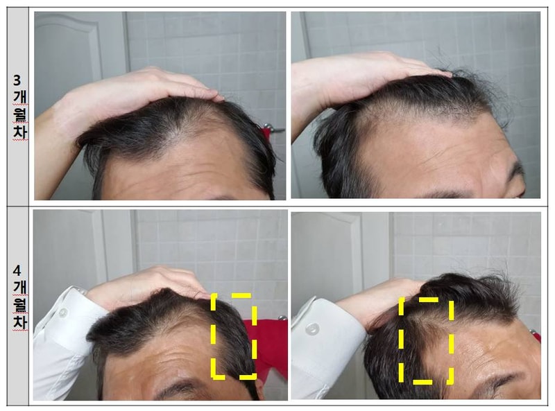 4개월차.jpg