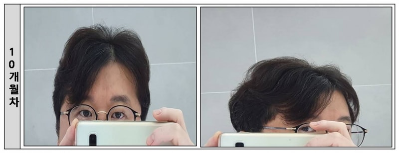 03.10개월.jpg