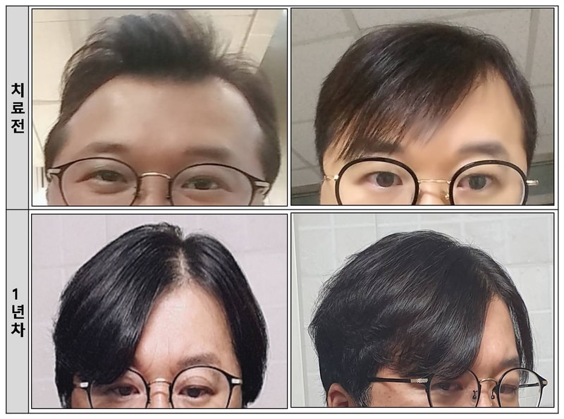 1년차.jpg